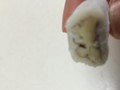 ナッツの断面